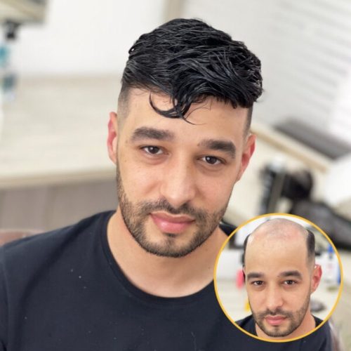Mono Base Toupee for Men